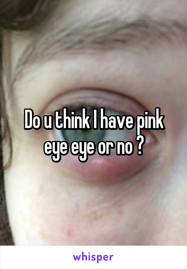 Do u think I have pink eye eye or no ?