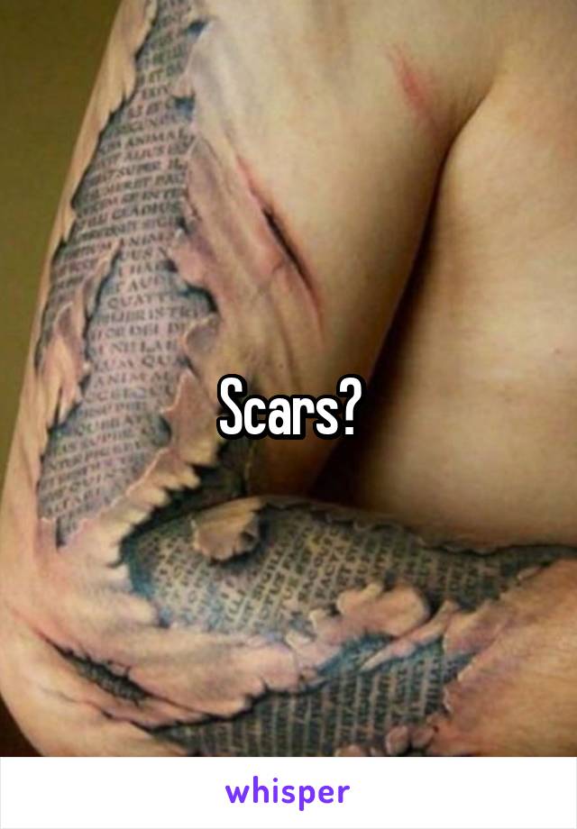 Scars?
