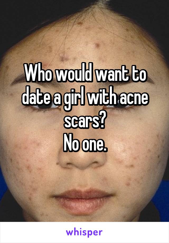 Who would want to date a girl with acne scars?
No one.
