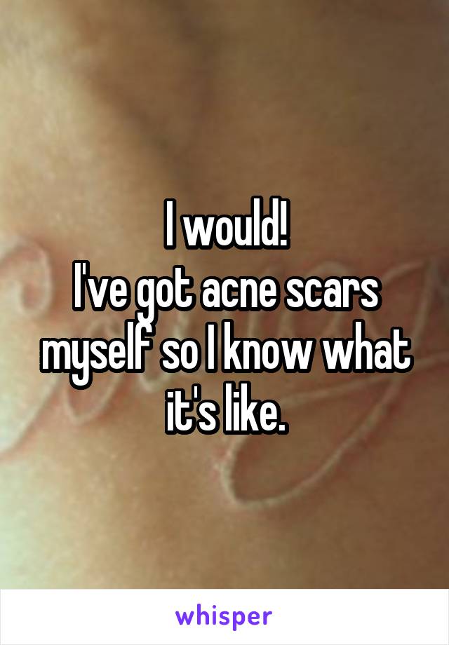 I would!
I've got acne scars myself so I know what it's like.