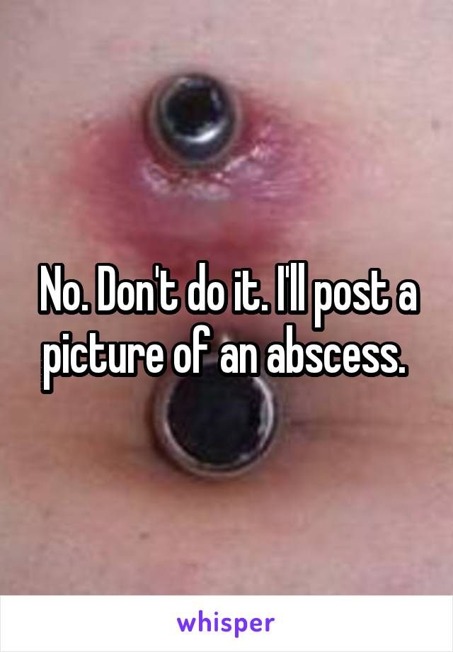 No. Don't do it. I'll post a picture of an abscess. 