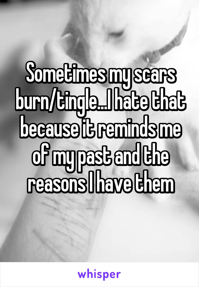 Sometimes my scars burn/tingle...I hate that because it reminds me of my past and the reasons I have them
