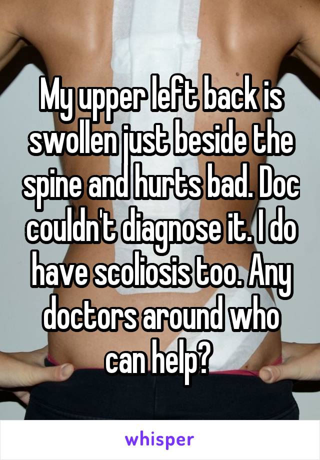 My upper left back is swollen just beside the spine and hurts bad. Doc couldn't diagnose it. I do have scoliosis too. Any doctors around who can help? 