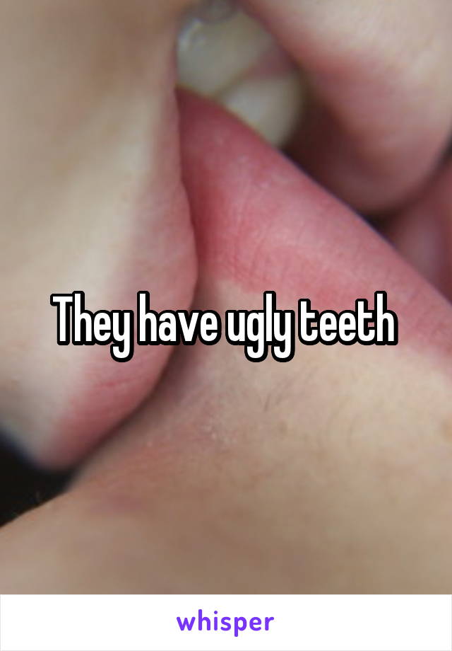 They have ugly teeth 