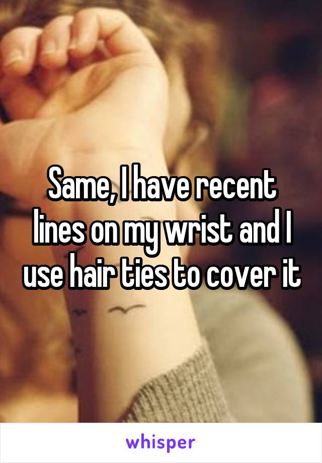 Same, I have recent lines on my wrist and I use hair ties to cover it