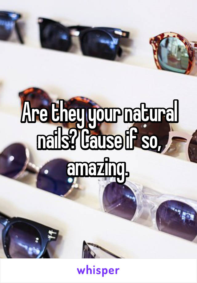 Are they your natural nails? Cause if so, amazing. 