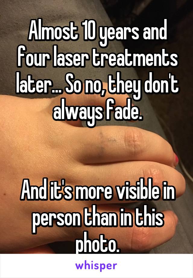 Almost 10 years and four laser treatments later... So no, they don't always fade.


And it's more visible in person than in this photo.