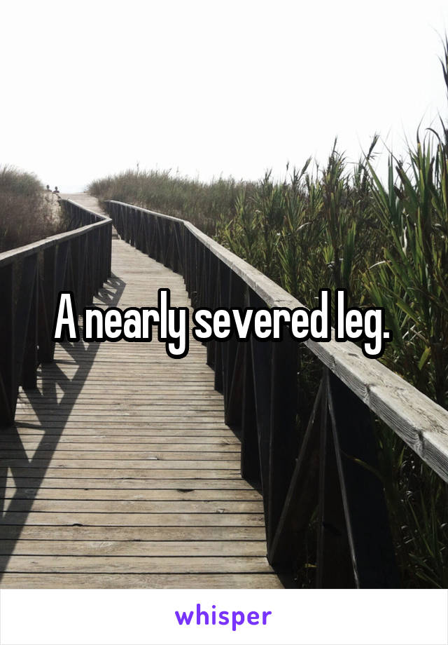 A nearly severed leg. 