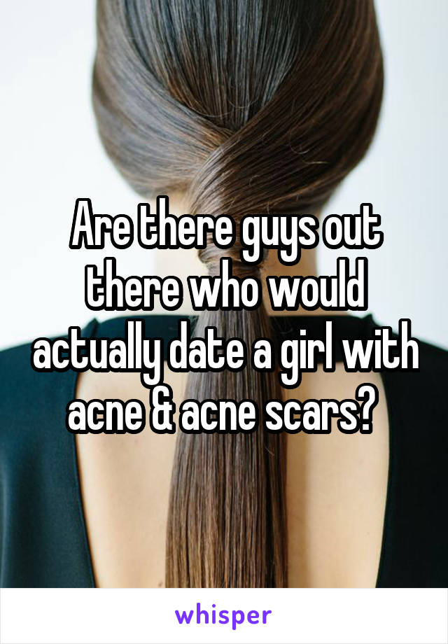 Are there guys out there who would actually date a girl with acne & acne scars? 