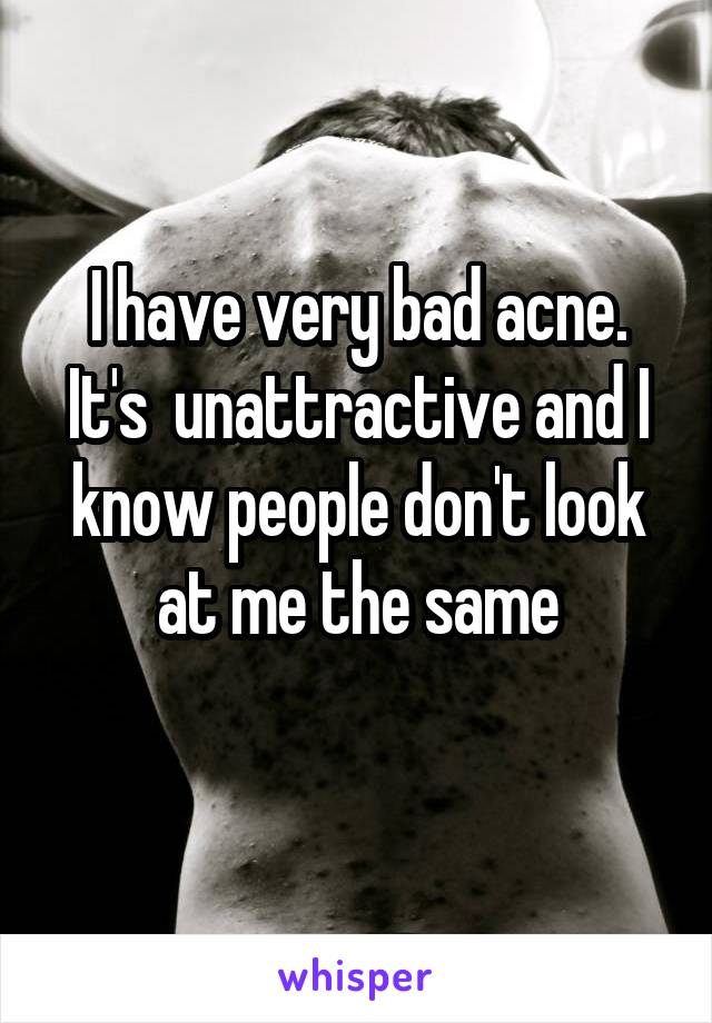 I have very bad acne. It's  unattractive and I know people don't look at me the same
