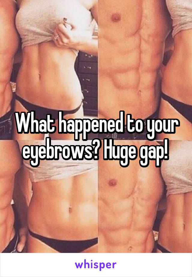 What happened to your eyebrows? Huge gap! 