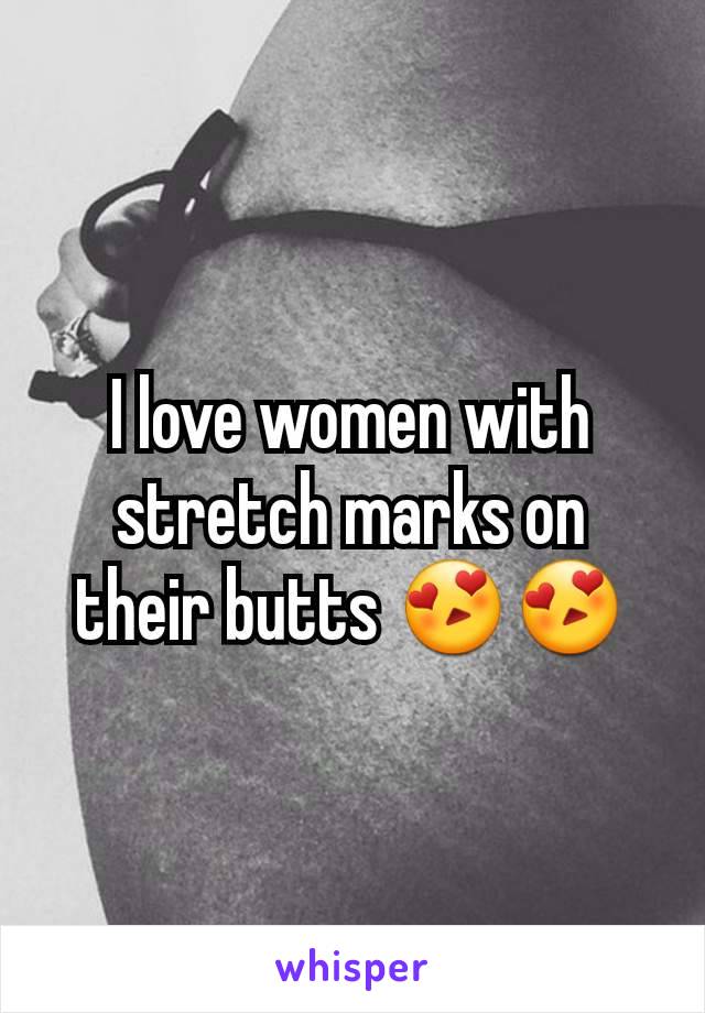 I love women with stretch marks on their butts 😍😍