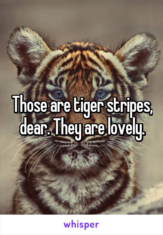 Those are tiger stripes, dear. They are lovely.