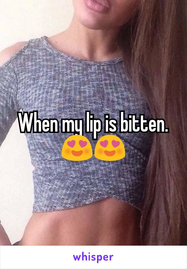 When my lip is bitten. 😍😍