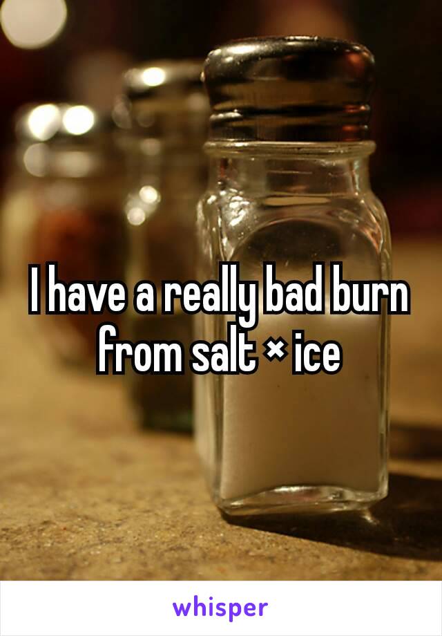 I have a really bad burn from salt × ice