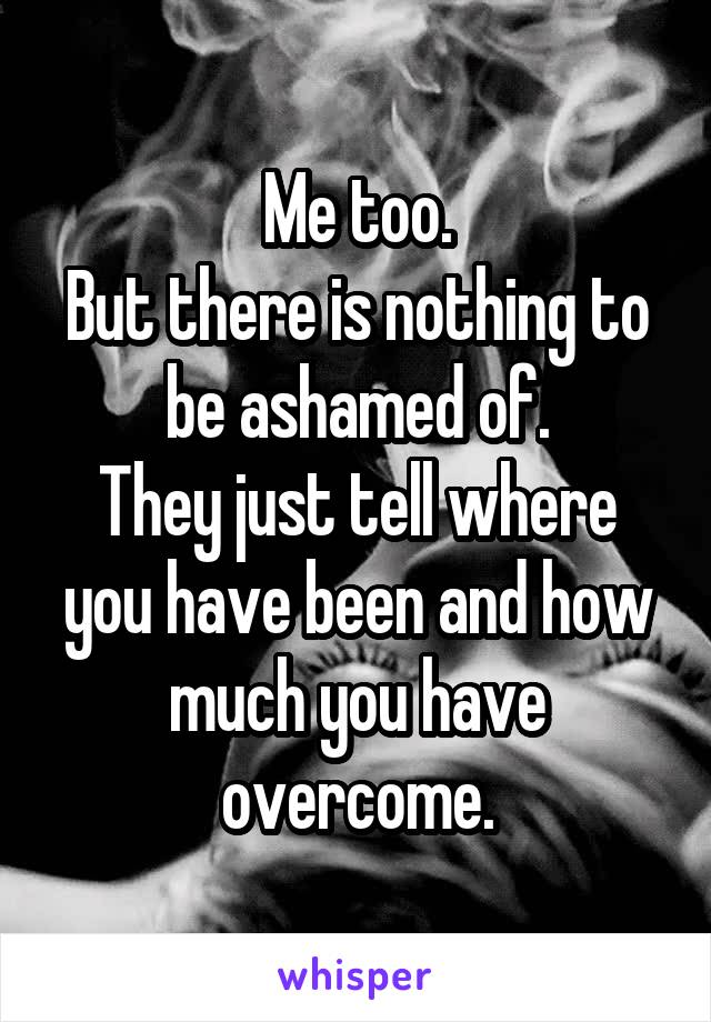 Me too.
But there is nothing to be ashamed of.
They just tell where you have been and how much you have overcome.