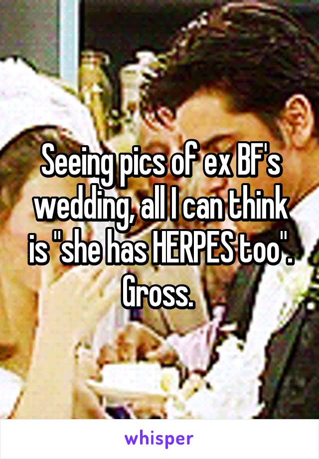 Seeing pics of ex BF's wedding, all I can think is "she has HERPES too". Gross. 