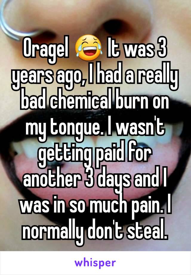 Oragel 😂 It was 3 years ago, I had a really bad chemical burn on my tongue. I wasn't getting paid for another 3 days and I was in so much pain. I normally don't steal.