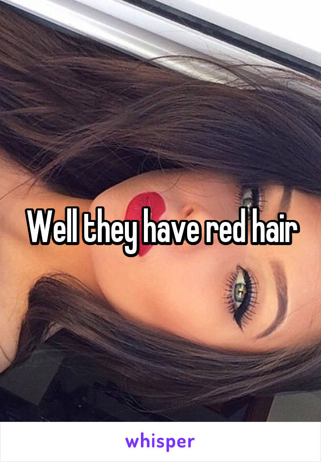 Well they have red hair