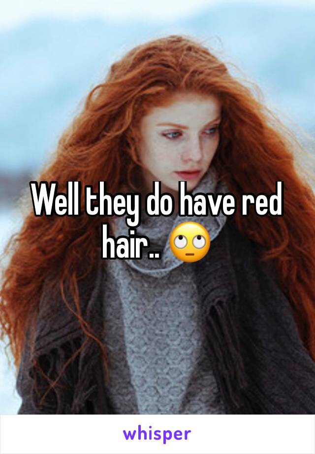 Well they do have red hair.. 🙄