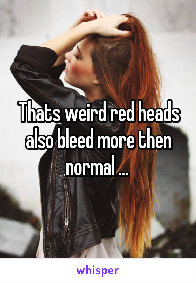 Thats weird red heads also bleed more then normal ... 