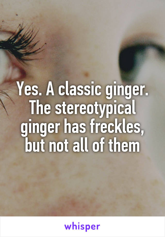 Yes. A classic ginger. The stereotypical ginger has freckles, but not all of them