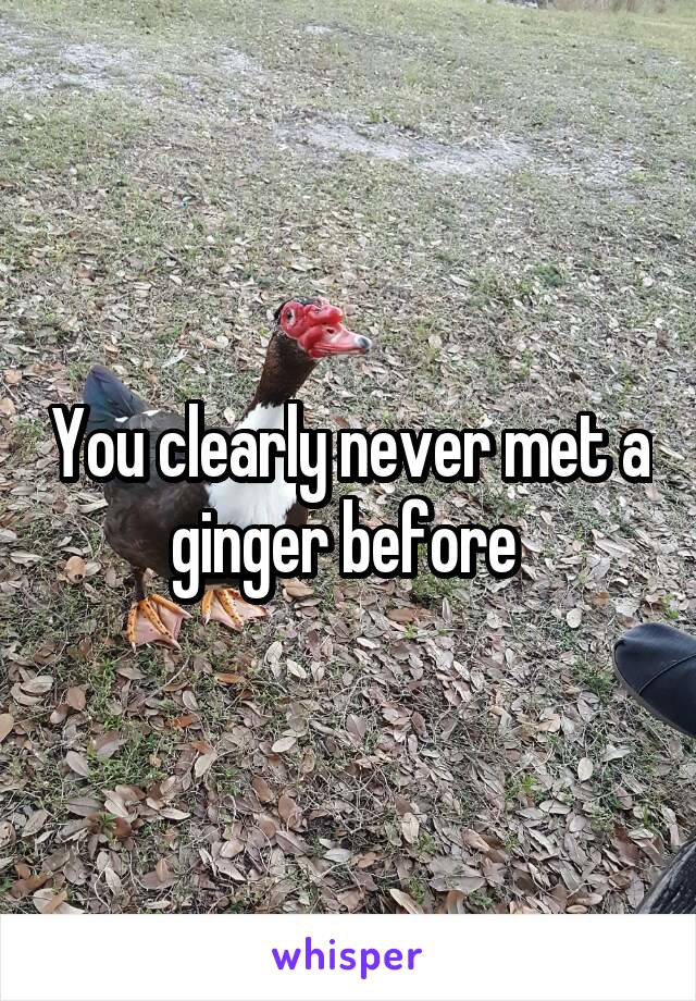 You clearly never met a ginger before 