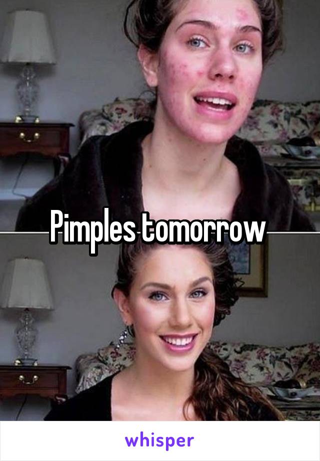 Pimples tomorrow 
