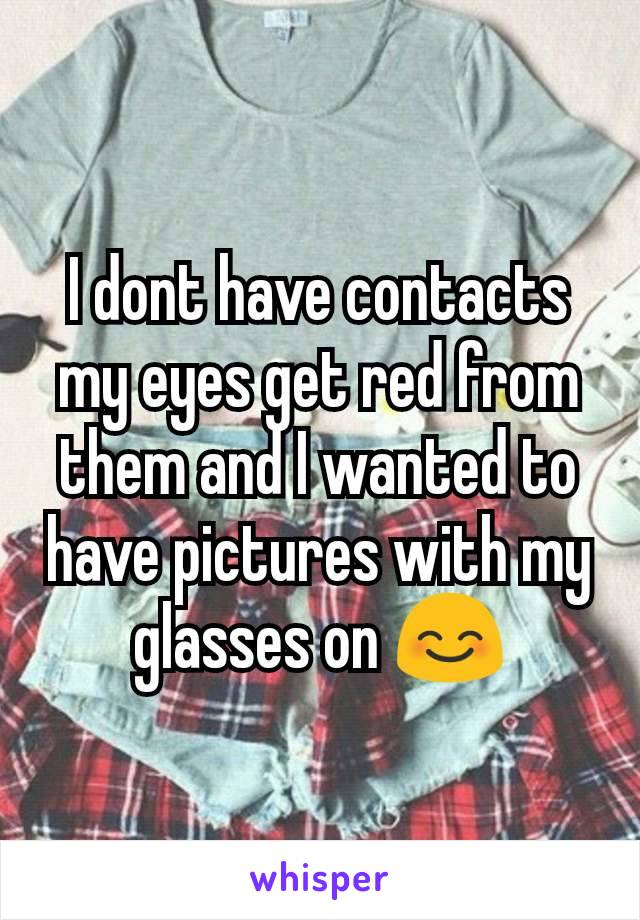 I dont have contacts my eyes get red from them and I wanted to have pictures with my glasses on 😊