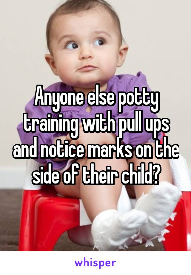 Anyone else potty training with pull ups and notice marks on the side of their child?