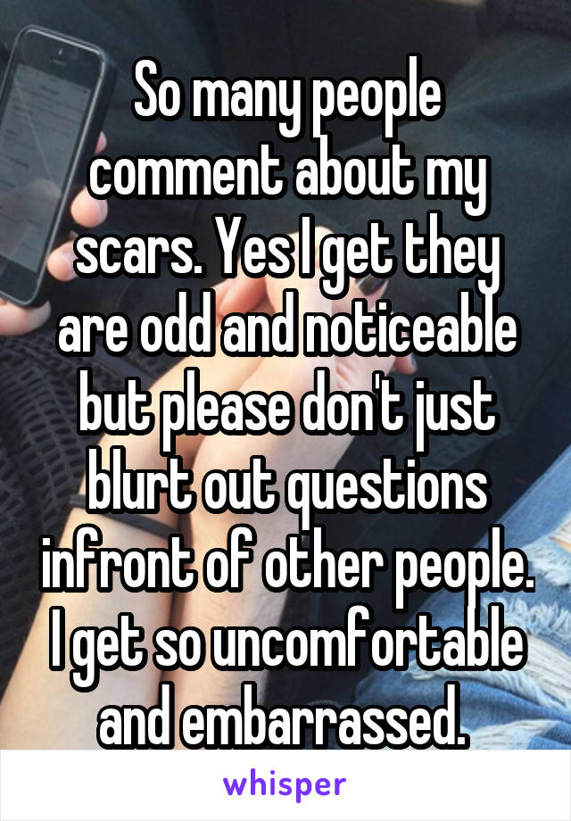 So many people comment about my scars. Yes I get they are odd and noticeable but please don't just blurt out questions infront of other people. I get so uncomfortable and embarrassed. 