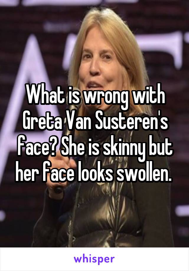 What is wrong with Greta Van Susteren's face? She is skinny but her face looks swollen. 