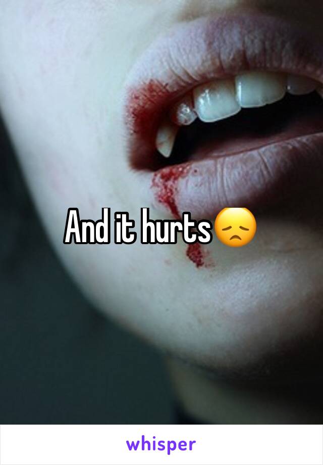 And it hurts😞