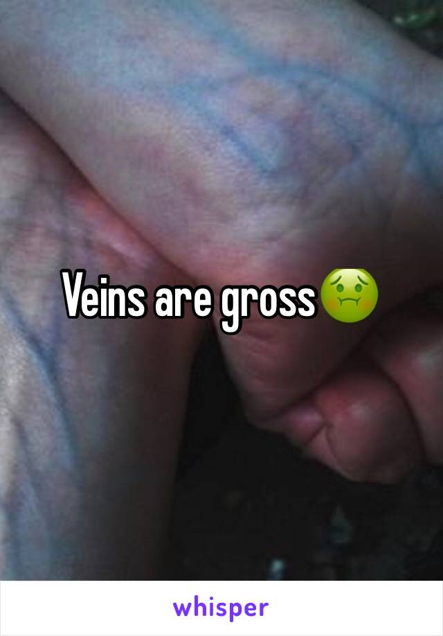 Veins are gross🤢