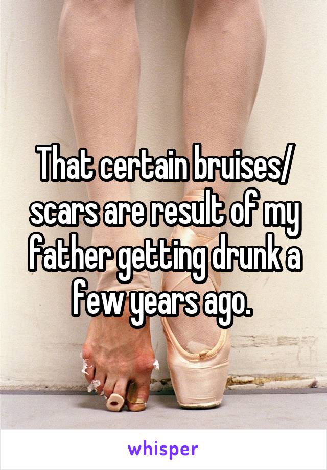 That certain bruises/ scars are result of my father getting drunk a few years ago. 