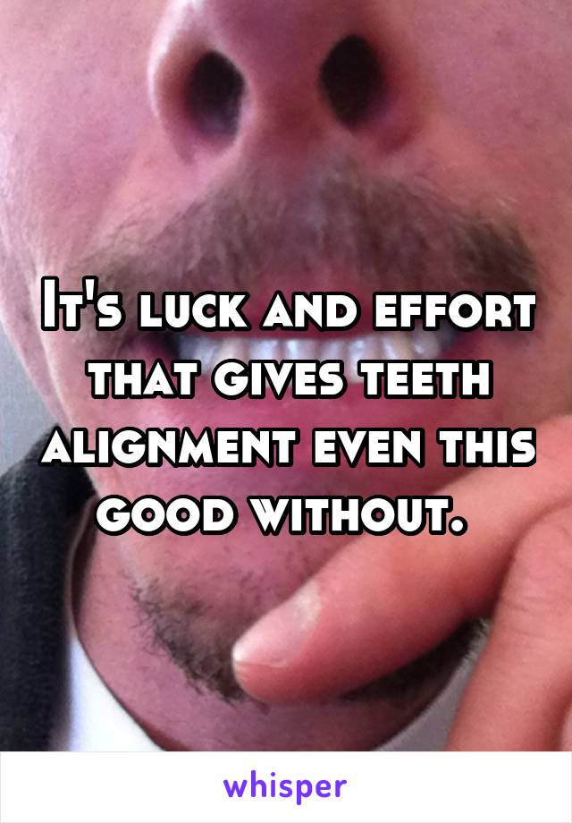 It's luck and effort that gives teeth alignment even this good without. 