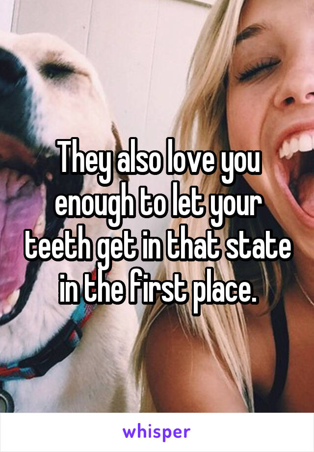 They also love you enough to let your teeth get in that state in the first place.