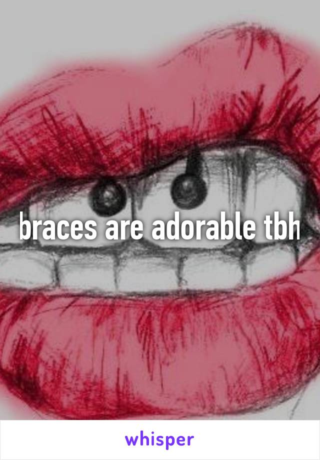 braces are adorable tbh