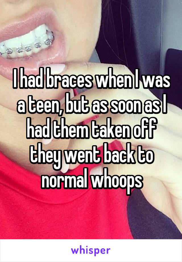 I had braces when I was a teen, but as soon as I had them taken off they went back to normal whoops