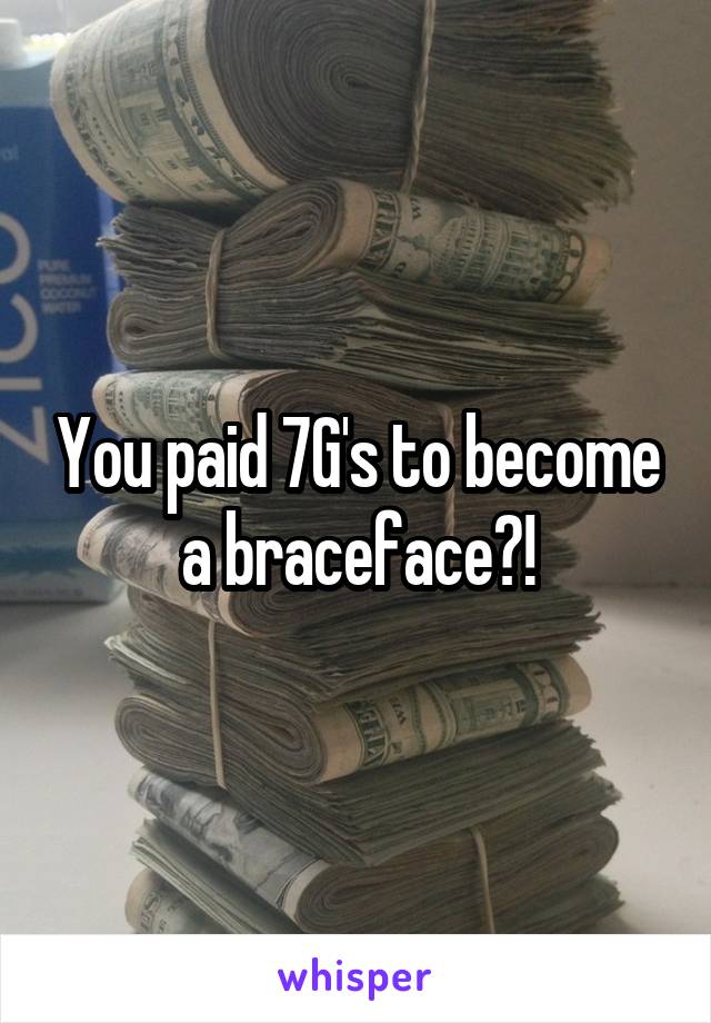 You paid 7G's to become a braceface?!