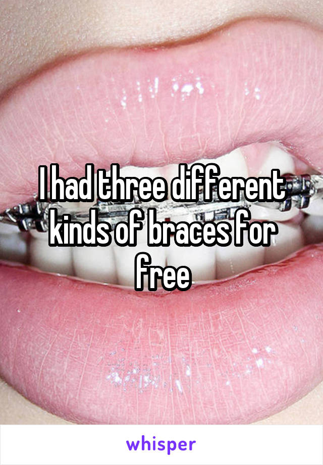 I had three different kinds of braces for free