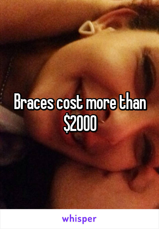 Braces cost more than $2000