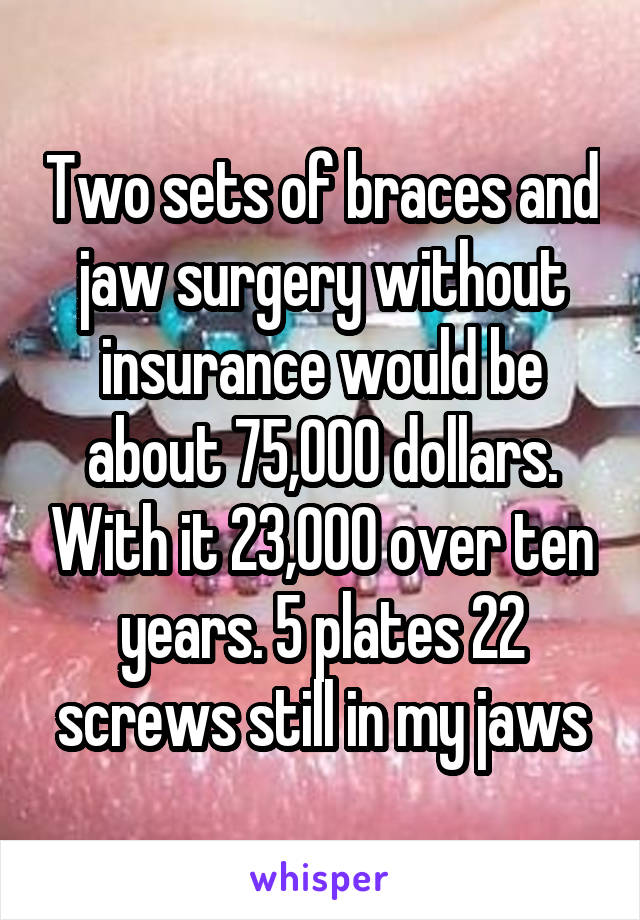 Two sets of braces and jaw surgery without insurance would be about 75,000 dollars. With it 23,000 over ten years. 5 plates 22 screws still in my jaws