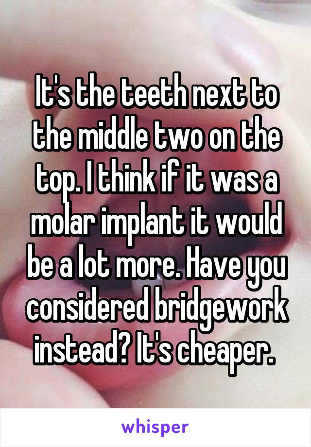 It's the teeth next to the middle two on the top. I think if it was a molar implant it would be a lot more. Have you considered bridgework instead? It's cheaper. 