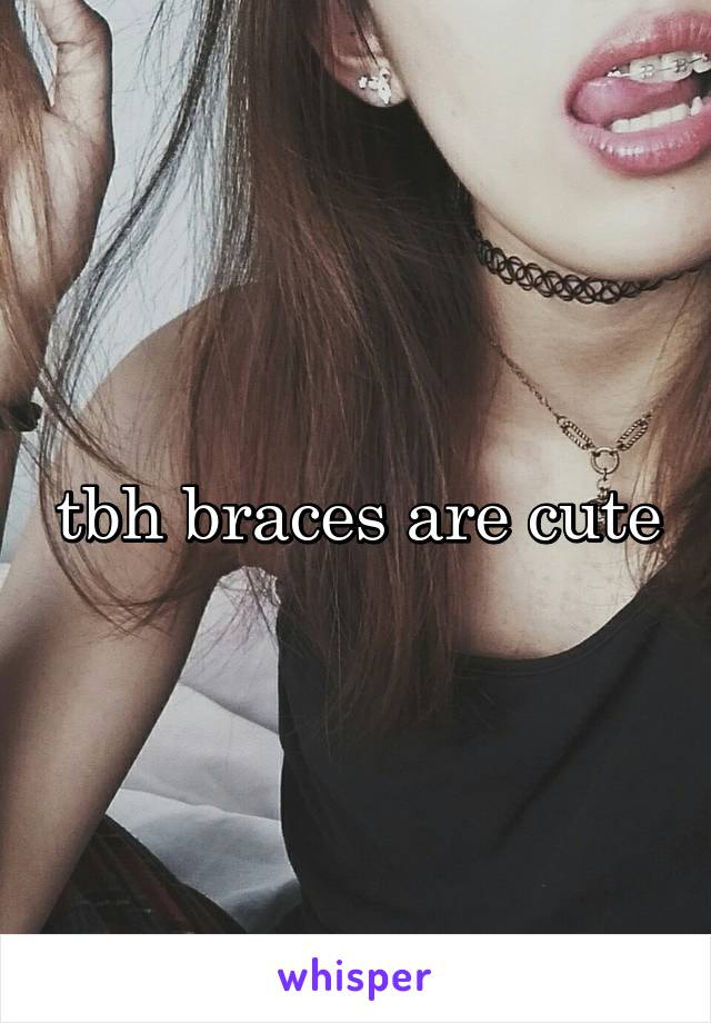 tbh braces are cute