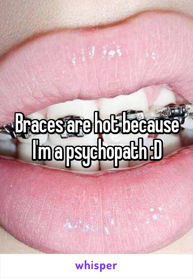 Braces are hot because I'm a psychopath :D