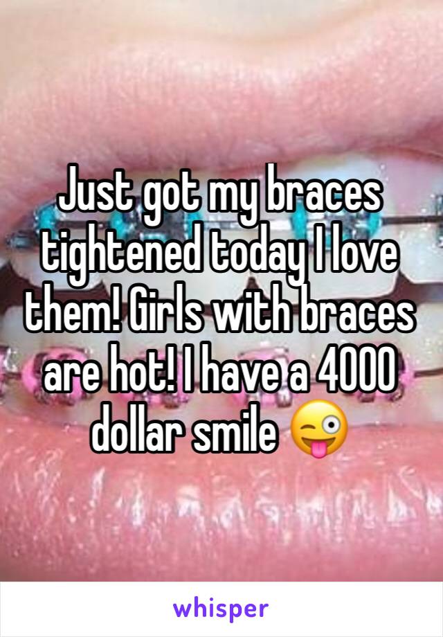 Just got my braces tightened today I love them! Girls with braces are hot! I have a 4000 dollar smile 😜