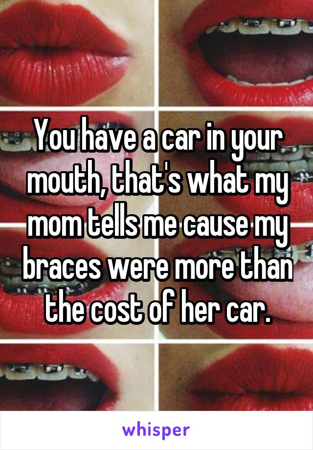 You have a car in your mouth, that's what my mom tells me cause my braces were more than the cost of her car.