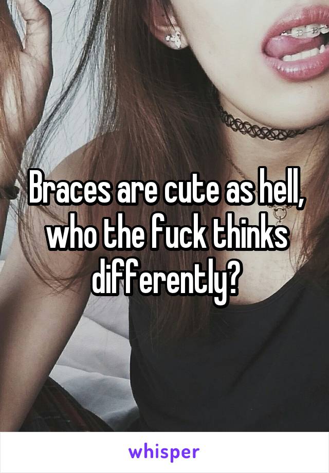 Braces are cute as hell, who the fuck thinks differently?