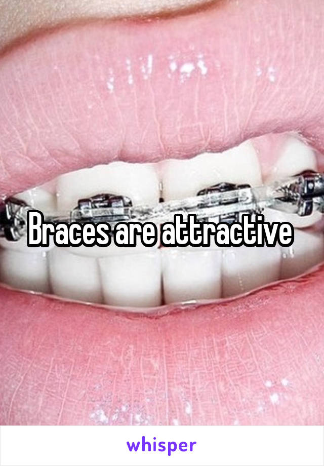 Braces are attractive 